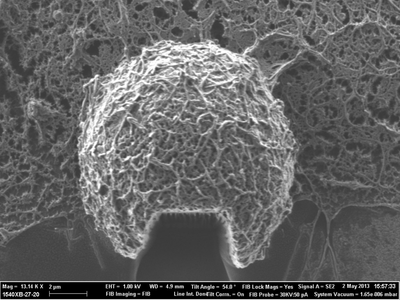 SEM image of a rounded cell surface above a FIB-milled trench exposing the internal cytoskeletal architecture