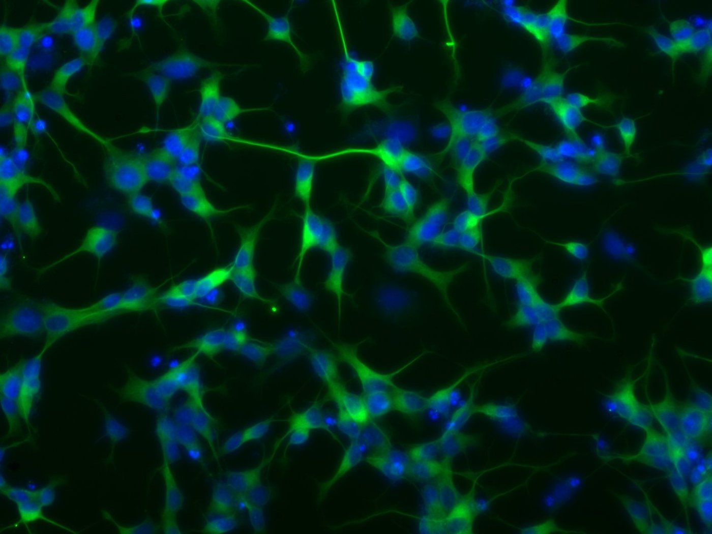 Fluorescence micrograph of a dense network of cells with cytoskeleton labelled in green and nuclei labelled in blue