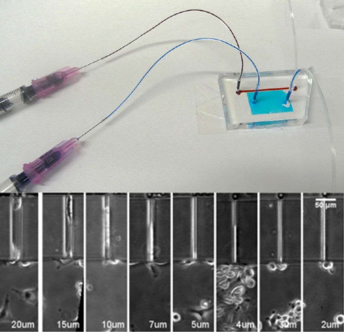 Fabricated microfluidic chip connected to syringes via tubing, with a micrograph series showing cells trapped at channel constrictions ranging from 20 to 2 micrometres